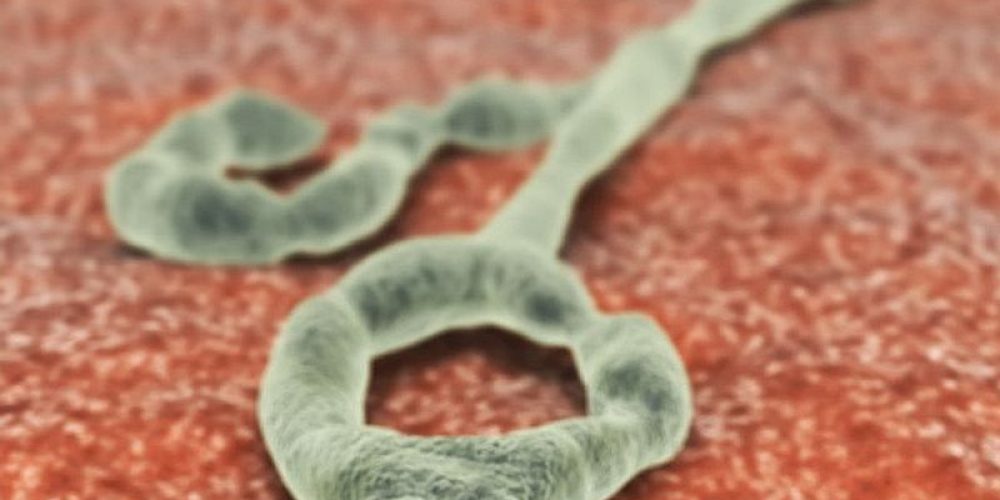 Tiny Genetic Tweak May Stop Ebola Virus in Its Tracks