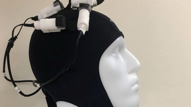 Wearable ‘Brain Stimulator’ May Boost Stroke Recovery