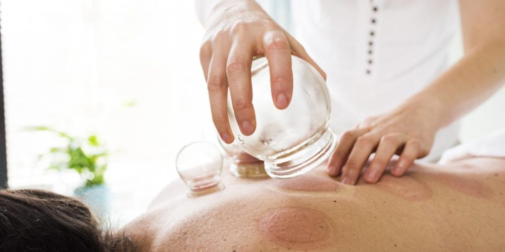 What to know about cupping therapy