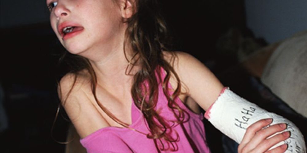 What&#8217;s the Best Treatment for a Child&#8217;s Broken Bone?