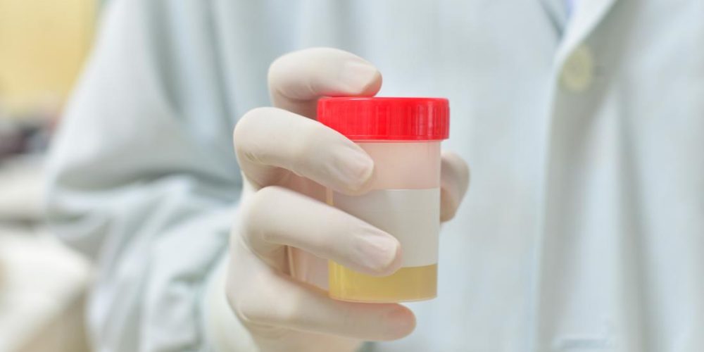Prostate cancer: Home urine test could &#8216;revolutionize diagnosis&#8217;