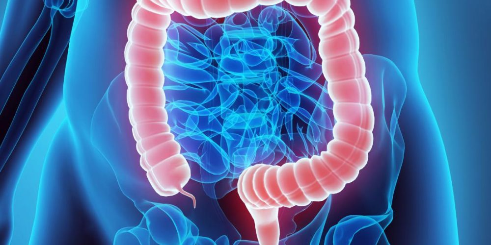 Could gut bacteria drive colon cancer?