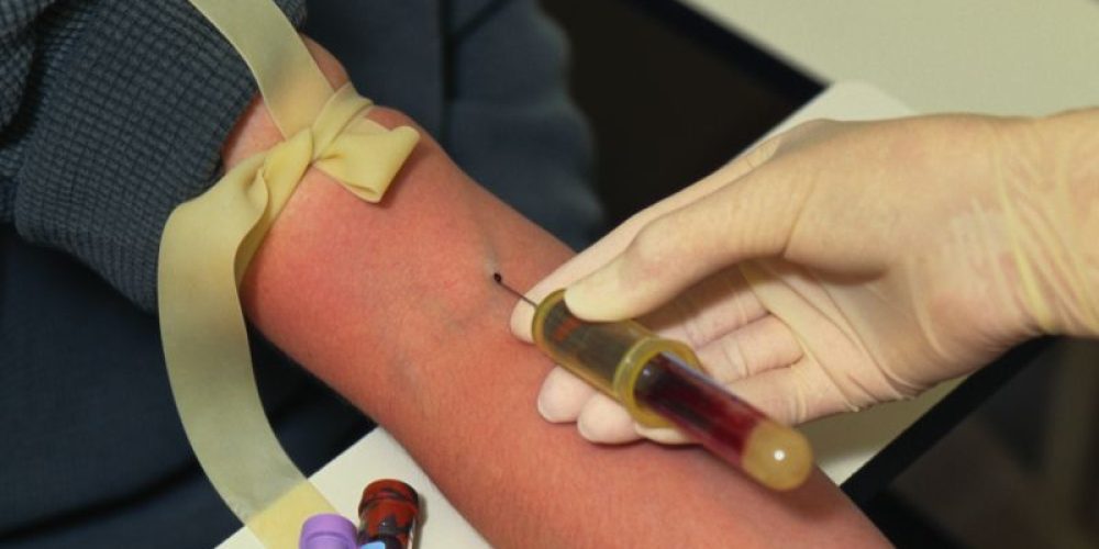 Do Diabetics Really Need to Fast for Blood Tests?