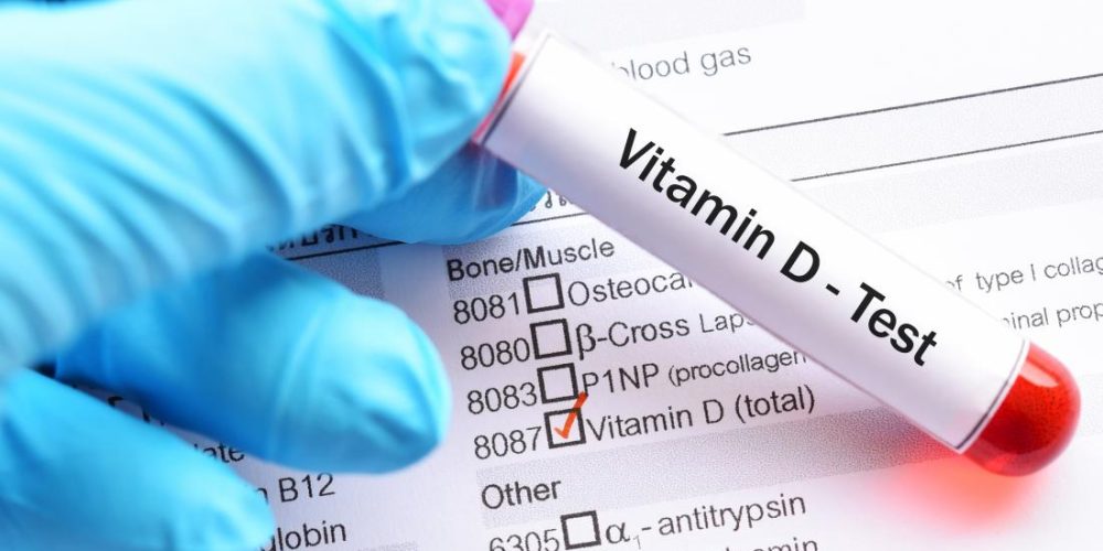 Do low vitamin D levels increase breast cancer risk?