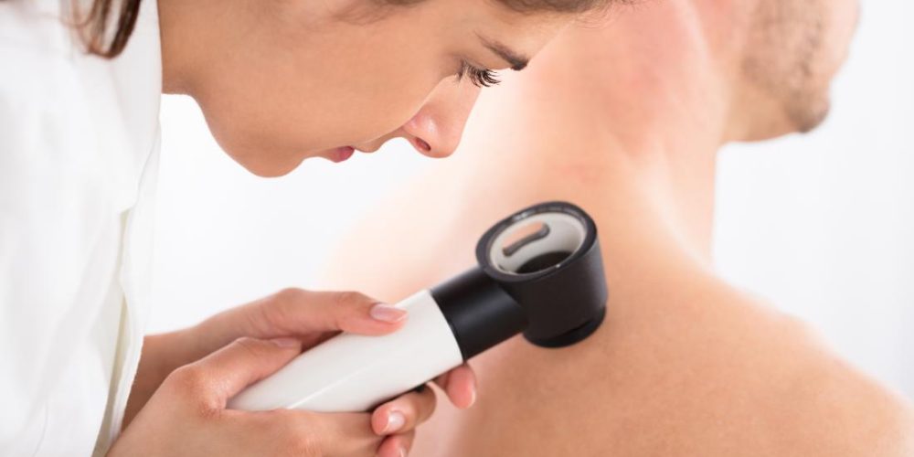 Weight loss reduces skin cancer risk