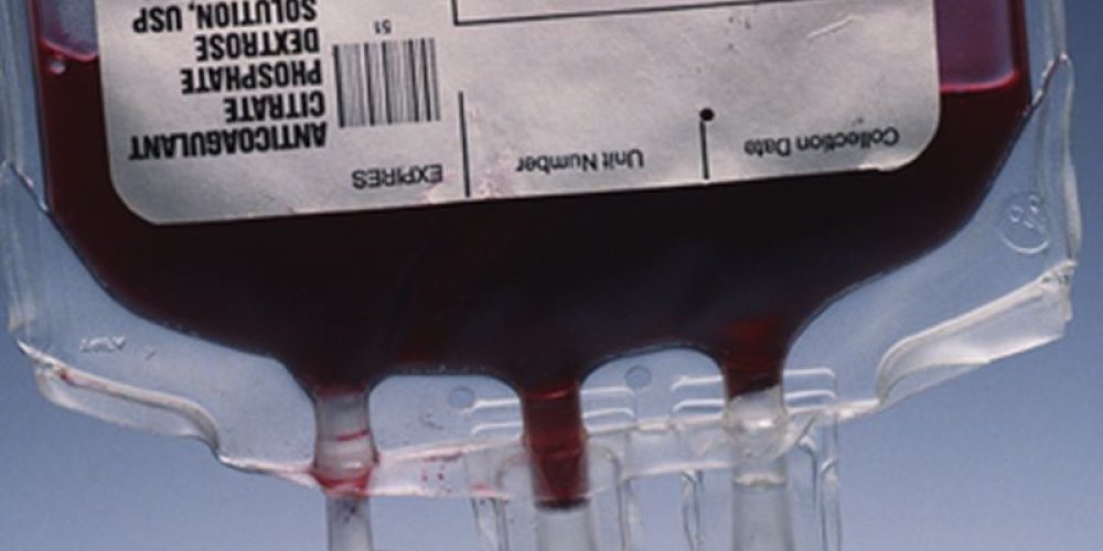 What If You Were Your Own Blood Donor for Surgery?