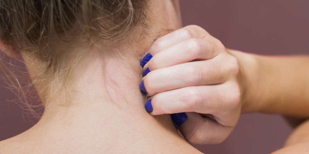 What to do about an itchy neck