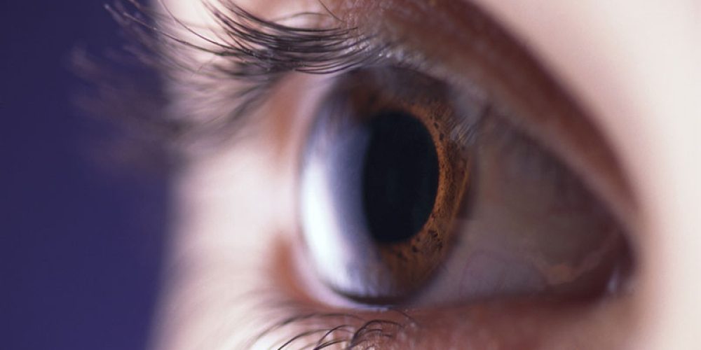 Dry Eye and Migraines Might Be Linked: Study