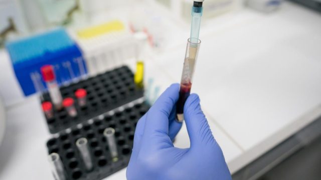 Alzheimer’s blood test almost ‘usable in routine clinical care’