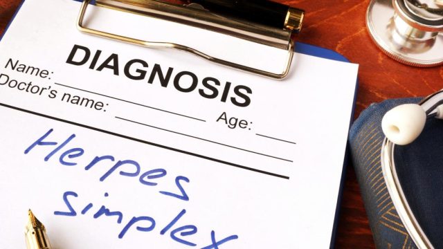 Herpes may account for 50 percent of Alzheimer’s cases