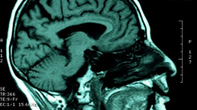 Only Spoken Words Processed in Newly Discovered Brain Region
